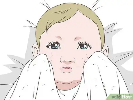 Image titled Get Rid of Baby Acne Step 3