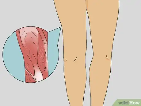 Image titled Give a Leg Massage Step 1