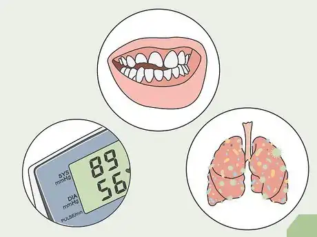 Image titled Administer General Anesthesia Step 7