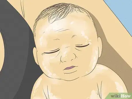 Image titled Know What to Expect on a Newborn's Skin Step 6