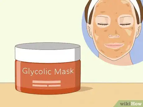 Image titled Reduce the Swelling and Redness of Pimples Step 8