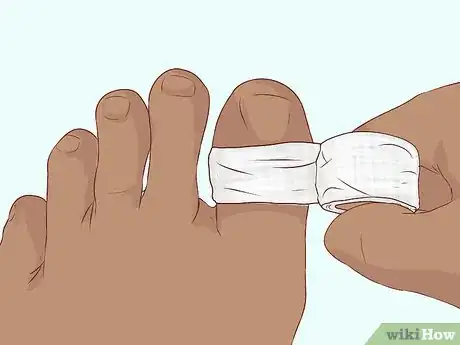 Image titled Bandage Fingers or Toes Step 14