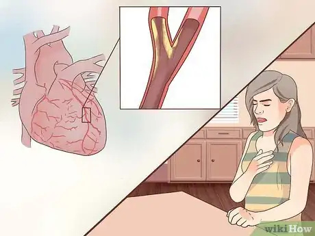 Image titled Know if You've Had a Heart Attack Step 4