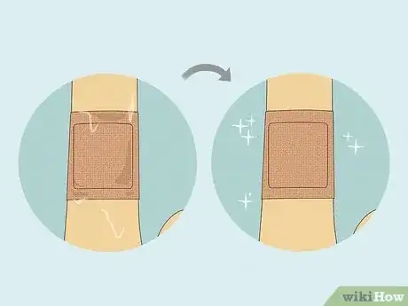 Image titled Apply Different Types of Bandages Step 13