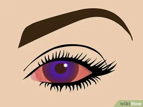 Image titled Get Colored Contacts to Change Your Eye Color Step 13