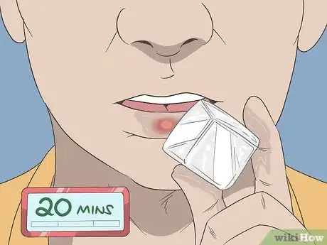 Image titled Get Rid of a Cold Sore with Home Remedies Step 8