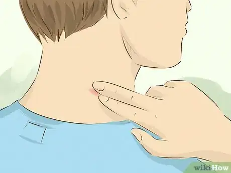 Image titled Hide a Hickey Step 16