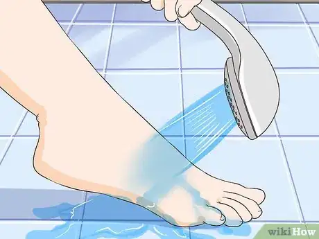 Image titled Remove Stains from Your Feet Step 10