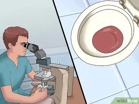 Image titled Detect Blood in Urine Step 10