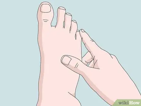 Image titled Crack Your Toe Step 2