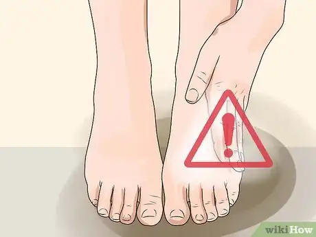 Image titled Check Feet for Complications of Diabetes Step 1