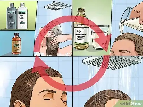 Image titled Remove Dandruff Using Vinegar Step 5