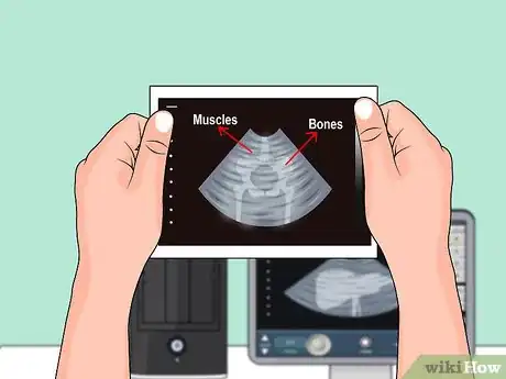 Image titled Use an Ultrasound Transducer Step 9