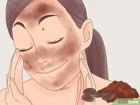 Image titled Remove Clogged Pores Under Your Eyes Step 5