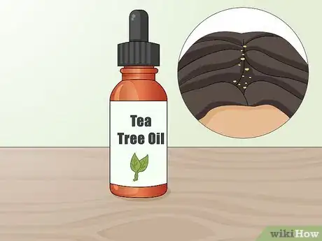 Image titled Use Essential Oils to Prevent an Itchy Scalp Step 1