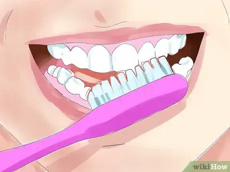 Image titled Bite Someone's Lip Step 13