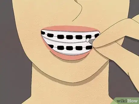 Image titled Make Out With Braces Step 2
