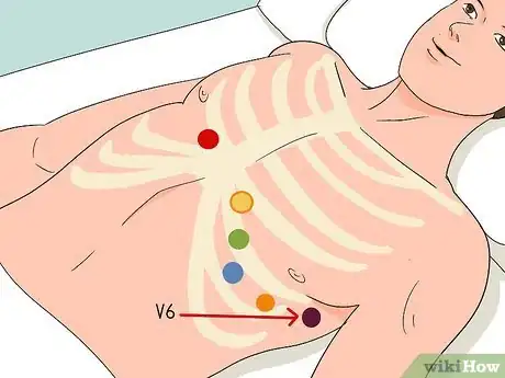 Image titled Put ECG Leads on a Chest Step 11