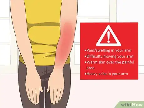 Image titled Treat DVT in Your Arm Step 8