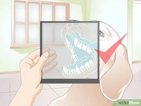 Image titled Adjust Abnormally Positioned Canine Teeth Step 11