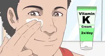 Treat Bruises on Your Face