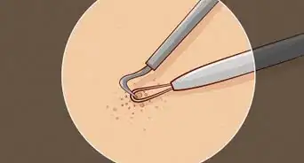 Close Blackhead Holes