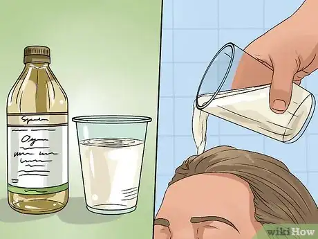 Image titled Remove Dandruff Using Vinegar Step 2