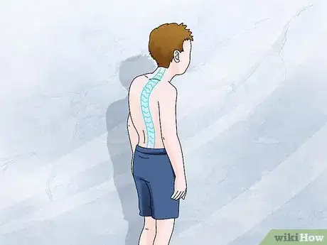 Image titled Avoid Kyphosis Step 1