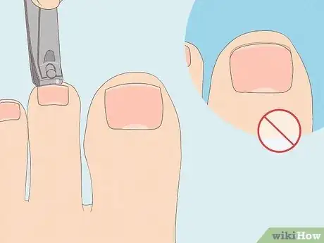 Image titled Protect Toenails when Running Step 6