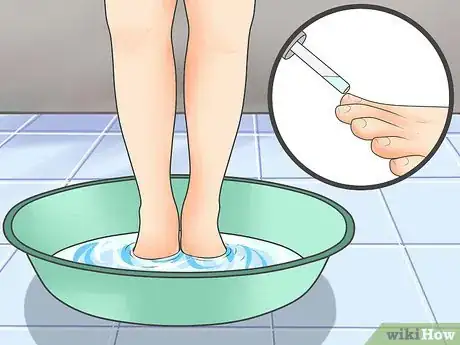 Image titled Tell if You Have an Ingrown Toenail Step 6