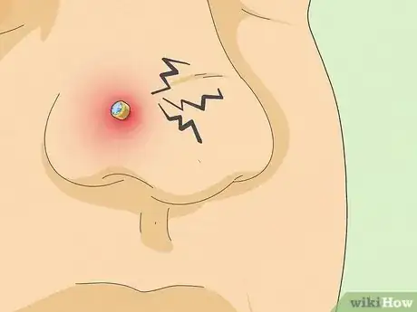 Image titled Treat an Infected Nose Piercing Step 13