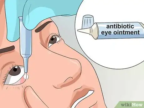 Image titled Get Rid of Pink Eye Fast Step 10