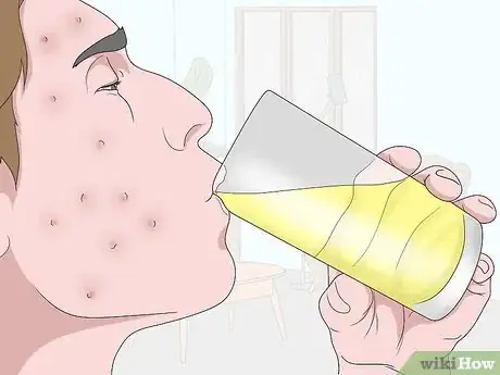 Image titled Treat Acne with Apple Cider Vinegar Step 15