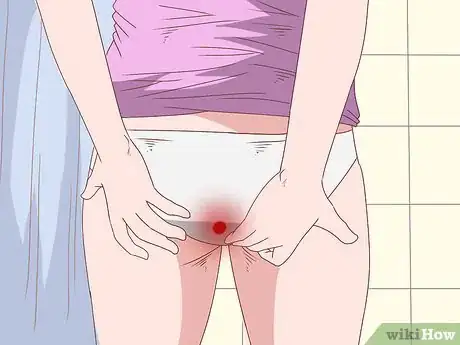 Image titled Care for Hemorrhoids Postpartum Step 3