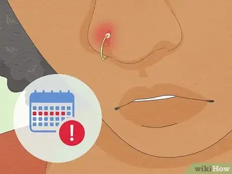 Image titled Treat an Infected Nose Piercing Step 10