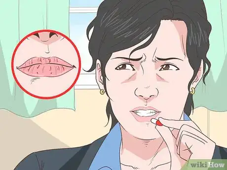 Image titled Prevent Dry Chapped Lips Step 13