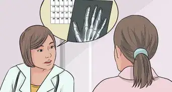 Know if You Sprained Your Finger