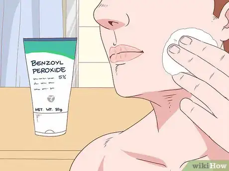 Image titled Stop a Zit from Bleeding Step 9