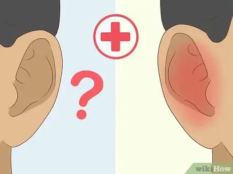 Image titled Prevent Earwax Buildup Step 9