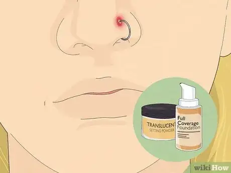 Image titled Treat an Infected Nose Piercing Step 18