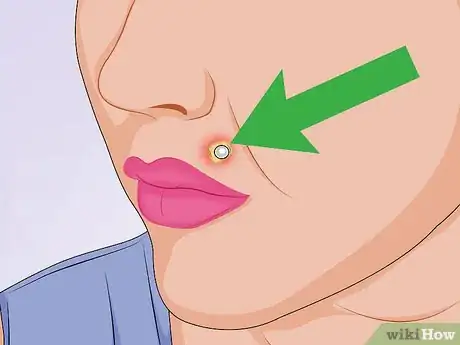 Image titled Tell if a Piercing Is Infected Step 5