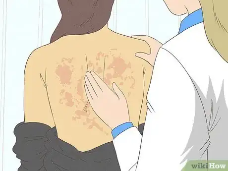 Image titled Get Rid of a Rash Step 13