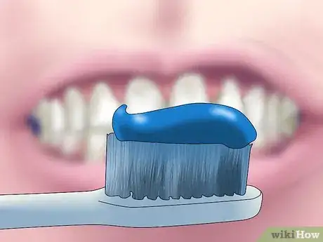 Image titled Reverse Dental Bone Loss Step 7