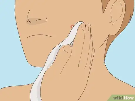 Image titled Get Rid of a Pimple Using Toothpaste Step 10