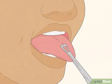 Image titled Pierce Your Own Tongue Step 7