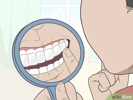 Image titled Put Invisalign Back in if You Haven't Worn Them for a Long Time Step 4