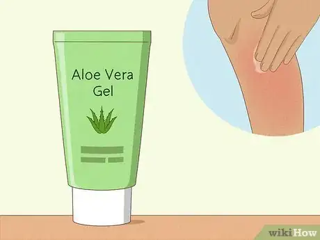 Image titled Prevent Ingrown Hairs After Waxing Using Home Remedies Step 9