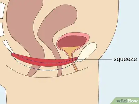 Image titled Do Bladder Training for Sudden Urges to Pee Step 7