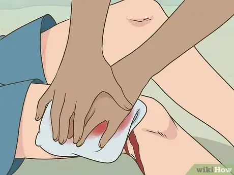 Image titled Use a Band Aid Step 11