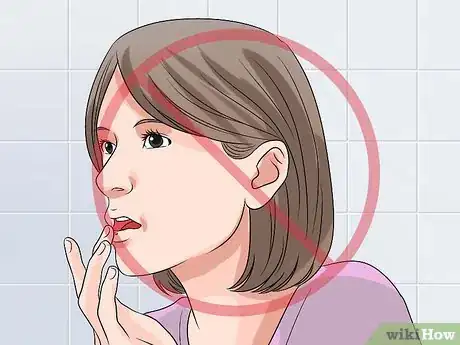 Image titled Stop a Cold Sore from Growing Step 10